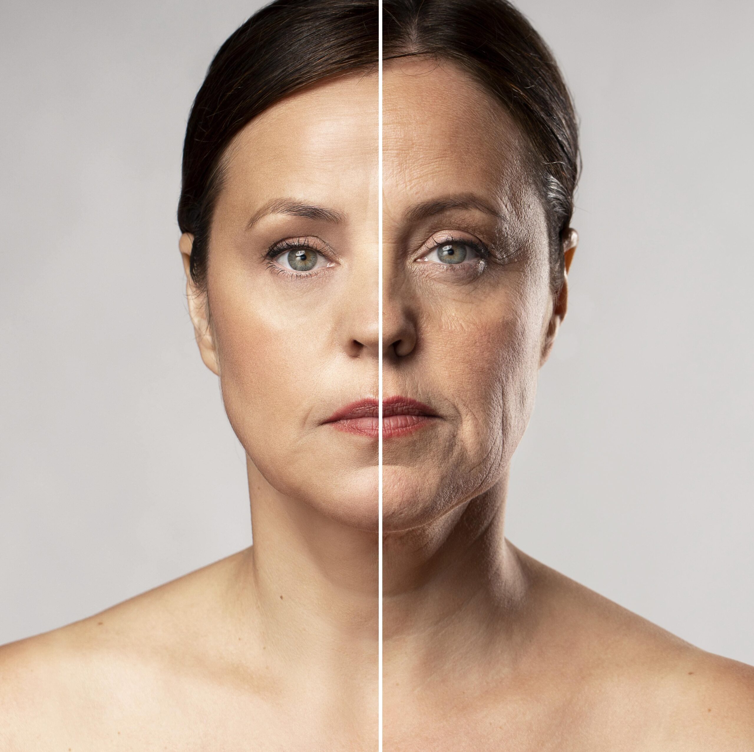 Wrinkles and Fine Lines