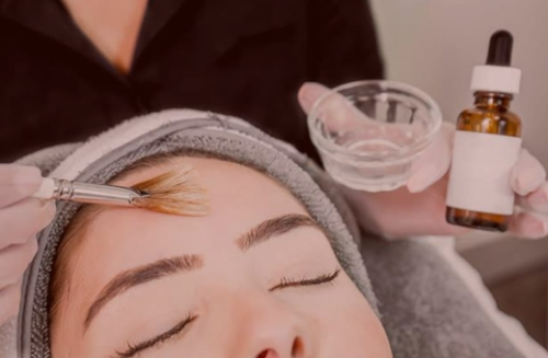 Chemical Peels